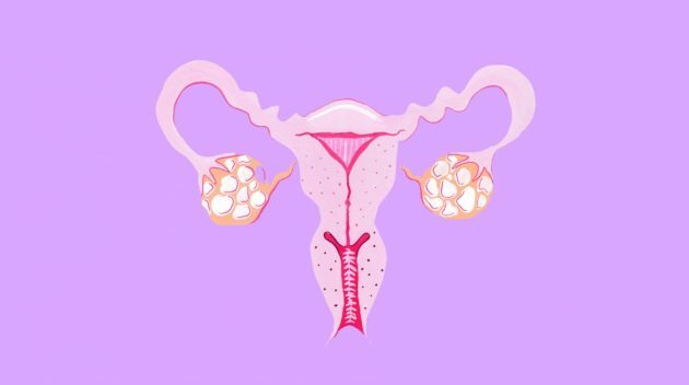 Menorāģija (hipermenoreja): kas tas ir sievietēm, kā ārstēt pēc 50 gadiem, pusaudžiem, ar menopauzi, ICD-10 kods, klīniskās vadlīnijas