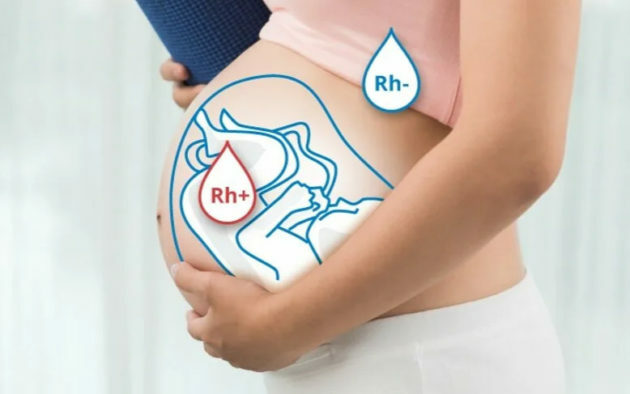Conflit rhésus pendant la grossesse: qu'est-ce que cela signifie, symptômes, comment éviter