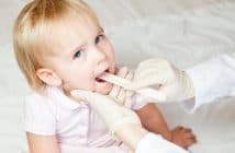 Tonsilopren in Polypen bei Kindern