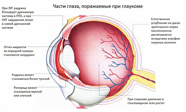 Taflotan - hatékony gyógyszer a glaukóma kezelésére