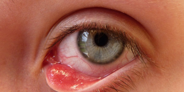 Emoksi-opticien zal helpen oogweefsel herstellen