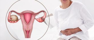 Ovarian cyste i overgangsalderen