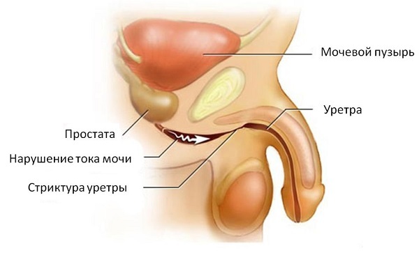 Udledning fra urinrøret hos mænd