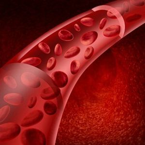 Vilka angioprotektorer används i phlebology: en lista över de bästa