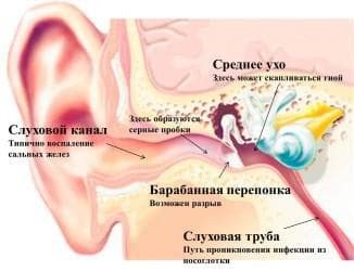 ausies simptomai suaugusiose nuotraukose